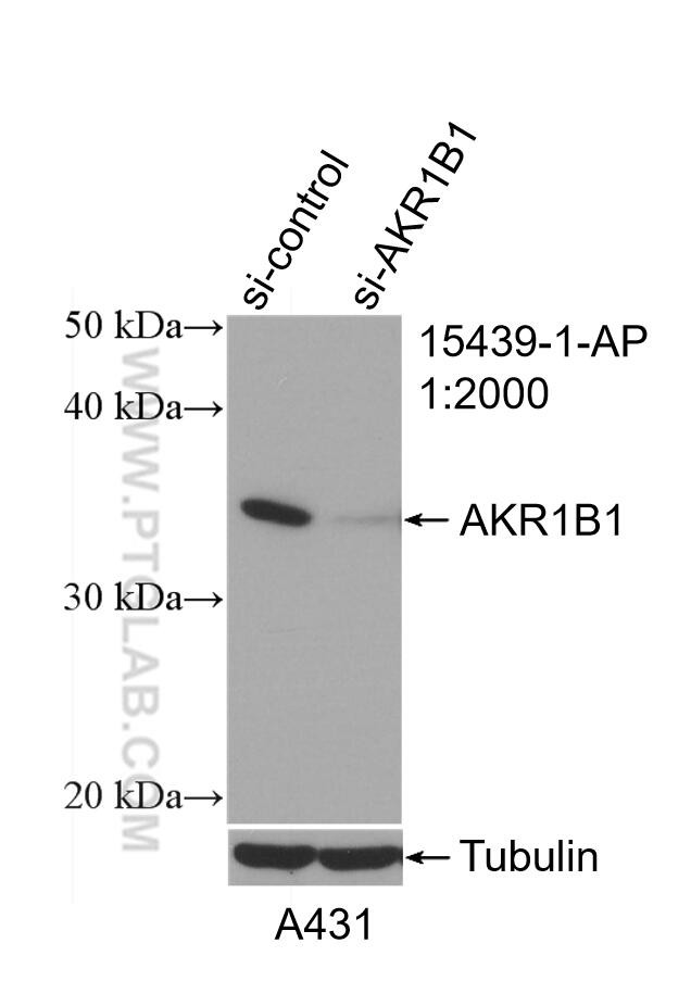 AKR1B1 Antibody in Western Blot (WB)