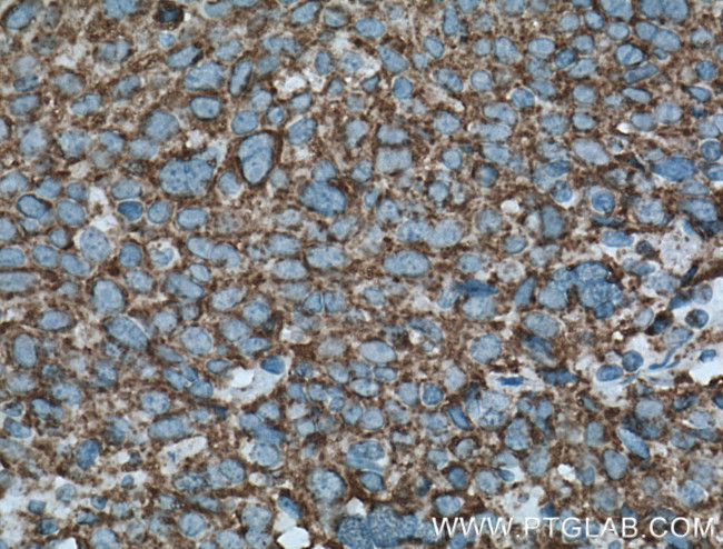 LONP1 Antibody in Immunohistochemistry (Paraffin) (IHC (P))