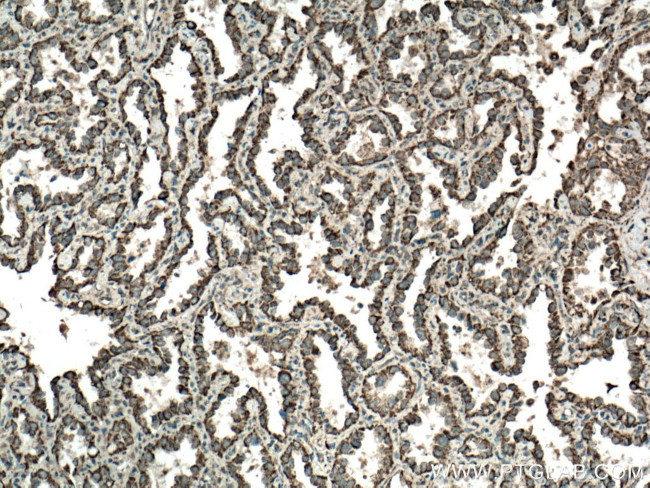 LONP1 Antibody in Immunohistochemistry (Paraffin) (IHC (P))