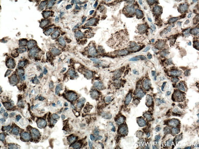 LONP1 Antibody in Immunohistochemistry (Paraffin) (IHC (P))