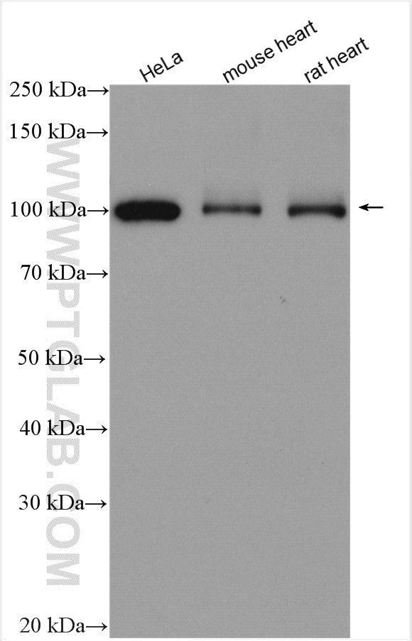 LONP1 Antibody in Western Blot (WB)