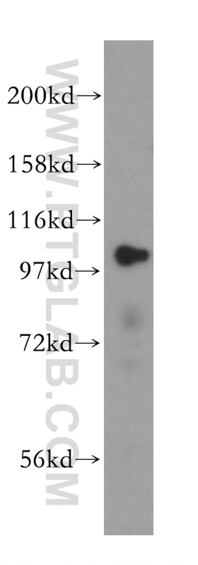 LONP1 Antibody in Western Blot (WB)