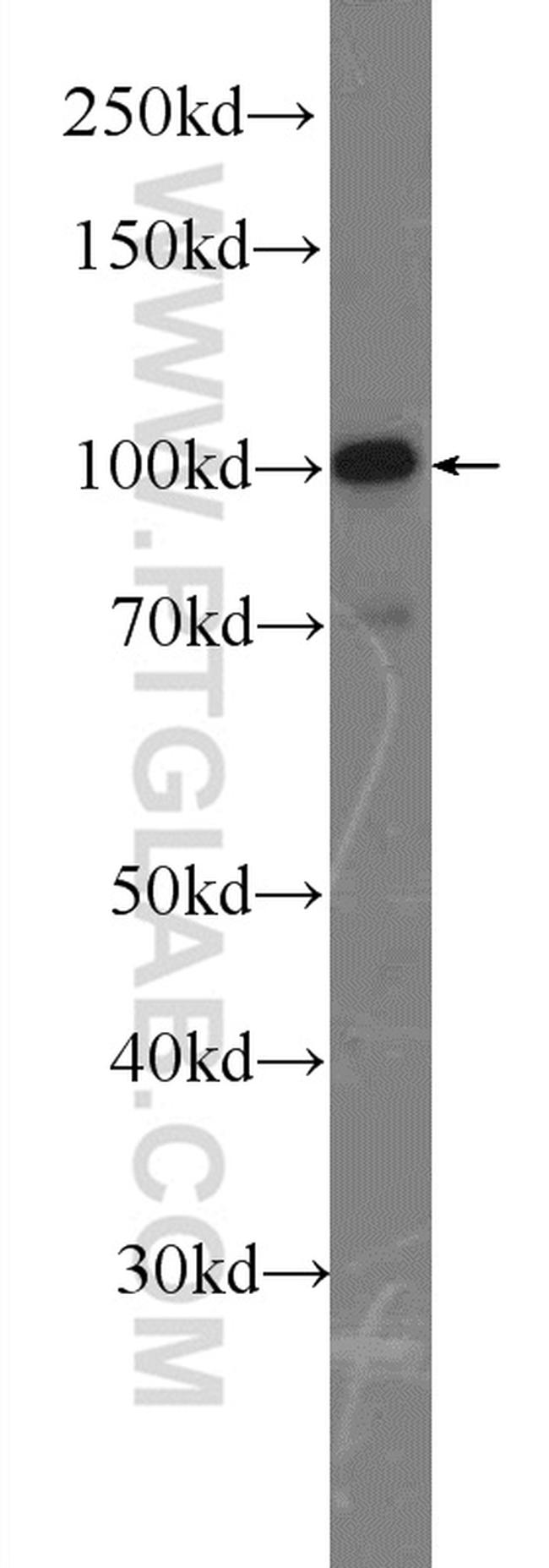 LONP1 Antibody in Western Blot (WB)