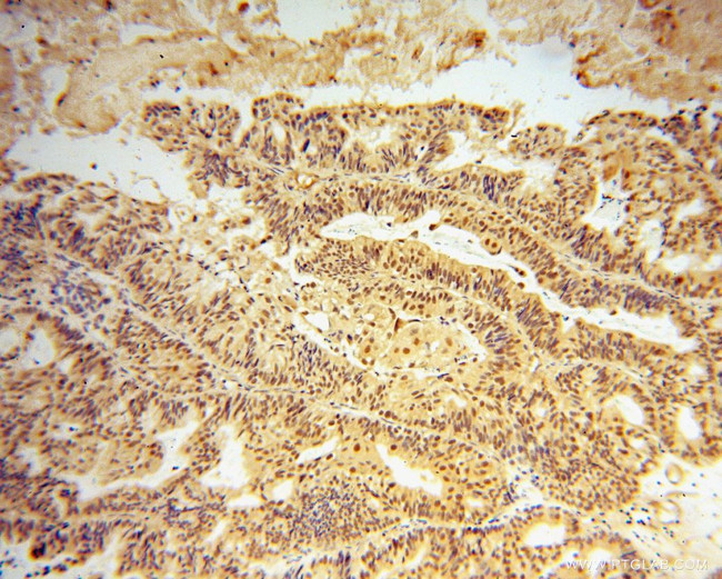 PAF1 Antibody in Immunohistochemistry (Paraffin) (IHC (P))