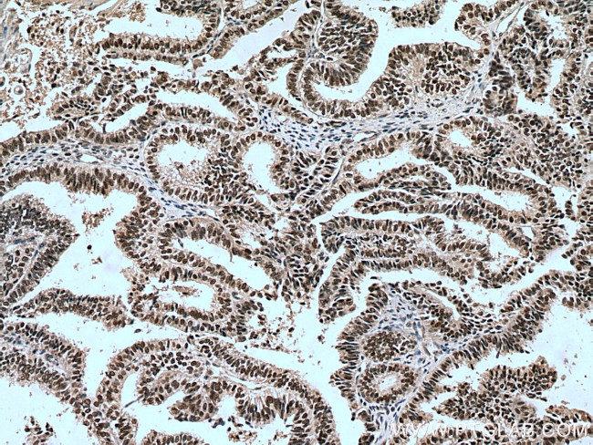 PAF1 Antibody in Immunohistochemistry (Paraffin) (IHC (P))