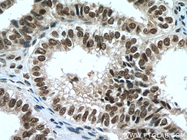 PAF1 Antibody in Immunohistochemistry (Paraffin) (IHC (P))