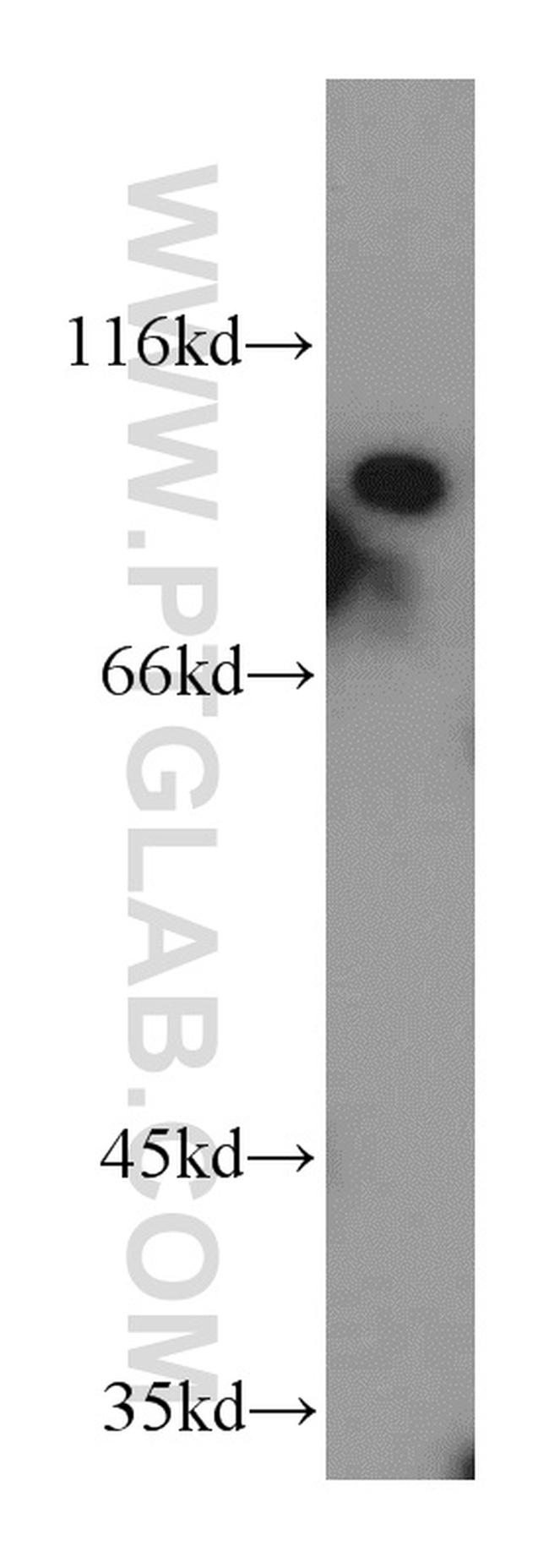 PAF1 Antibody in Western Blot (WB)