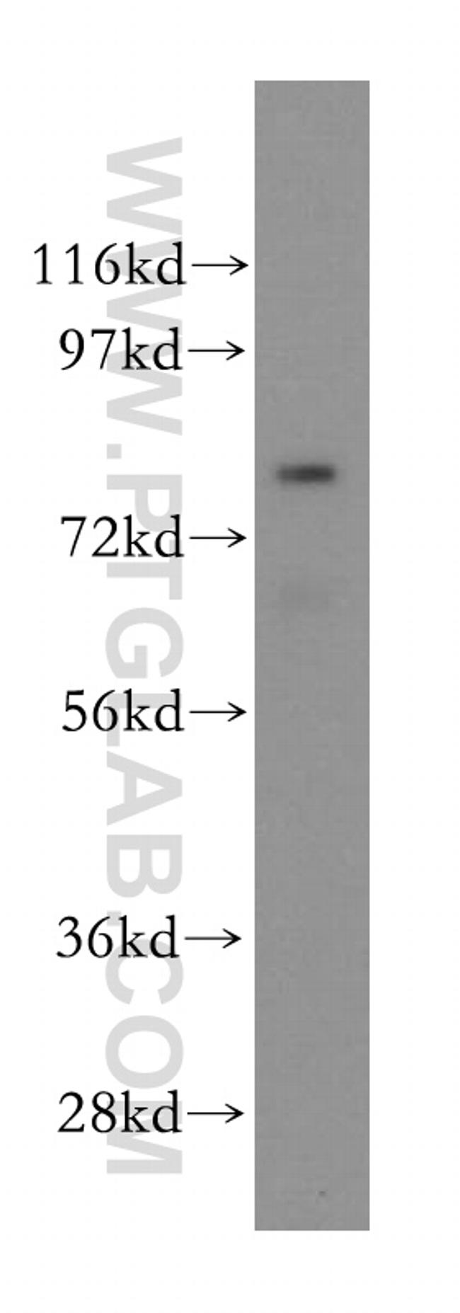 PAF1 Antibody in Western Blot (WB)