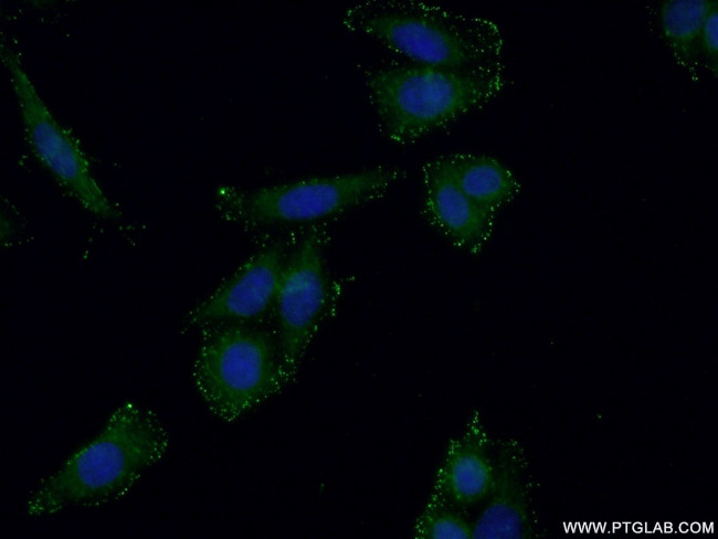 GMDS Antibody in Immunocytochemistry (ICC/IF)