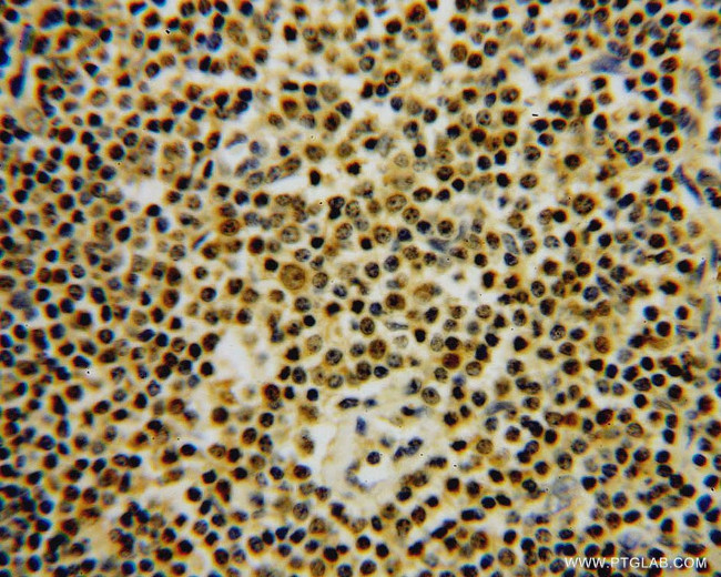 GMDS Antibody in Immunohistochemistry (Paraffin) (IHC (P))