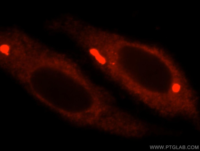 NSUN5 Antibody in Immunocytochemistry (ICC/IF)