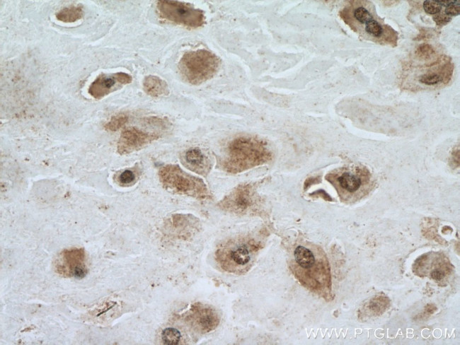 NSUN5 Antibody in Immunohistochemistry (Paraffin) (IHC (P))