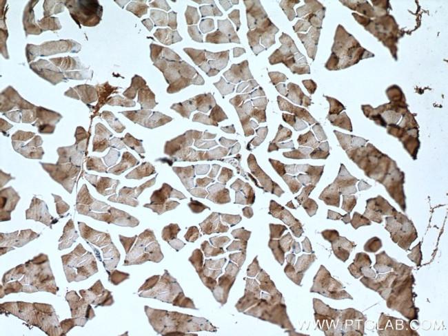 NSUN5 Antibody in Immunohistochemistry (Paraffin) (IHC (P))