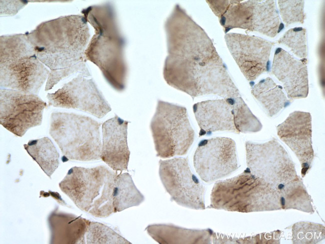 NSUN5 Antibody in Immunohistochemistry (Paraffin) (IHC (P))