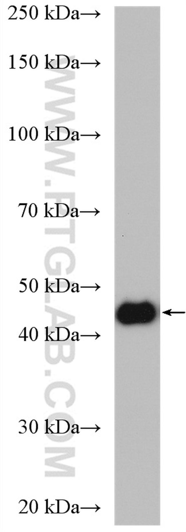 NSUN5 Antibody in Western Blot (WB)