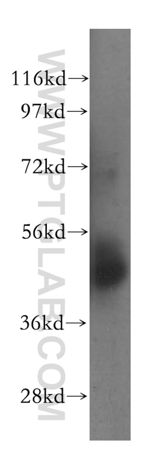 NSUN5 Antibody in Western Blot (WB)