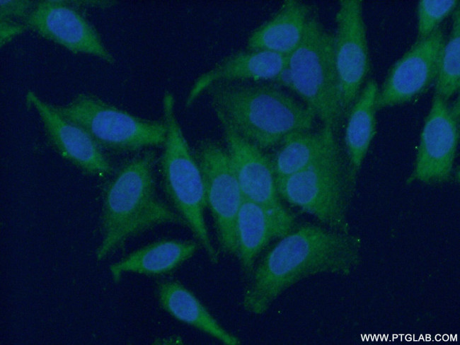 FA2H Antibody in Immunocytochemistry (ICC/IF)