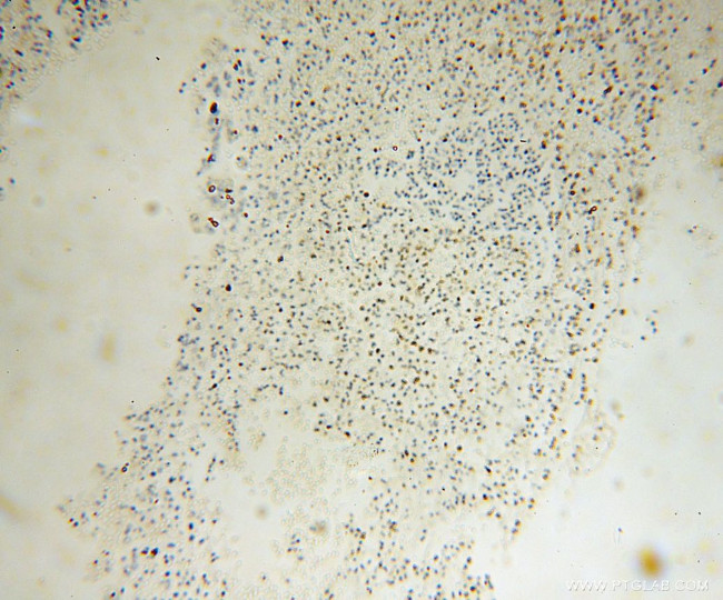 FA2H Antibody in Immunohistochemistry (Paraffin) (IHC (P))