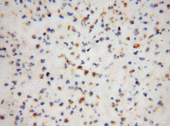 FA2H Antibody in Immunohistochemistry (Paraffin) (IHC (P))