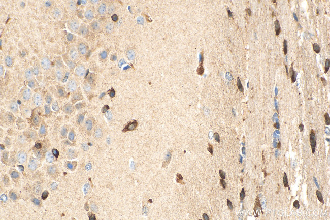 FA2H Antibody in Immunohistochemistry (Paraffin) (IHC (P))