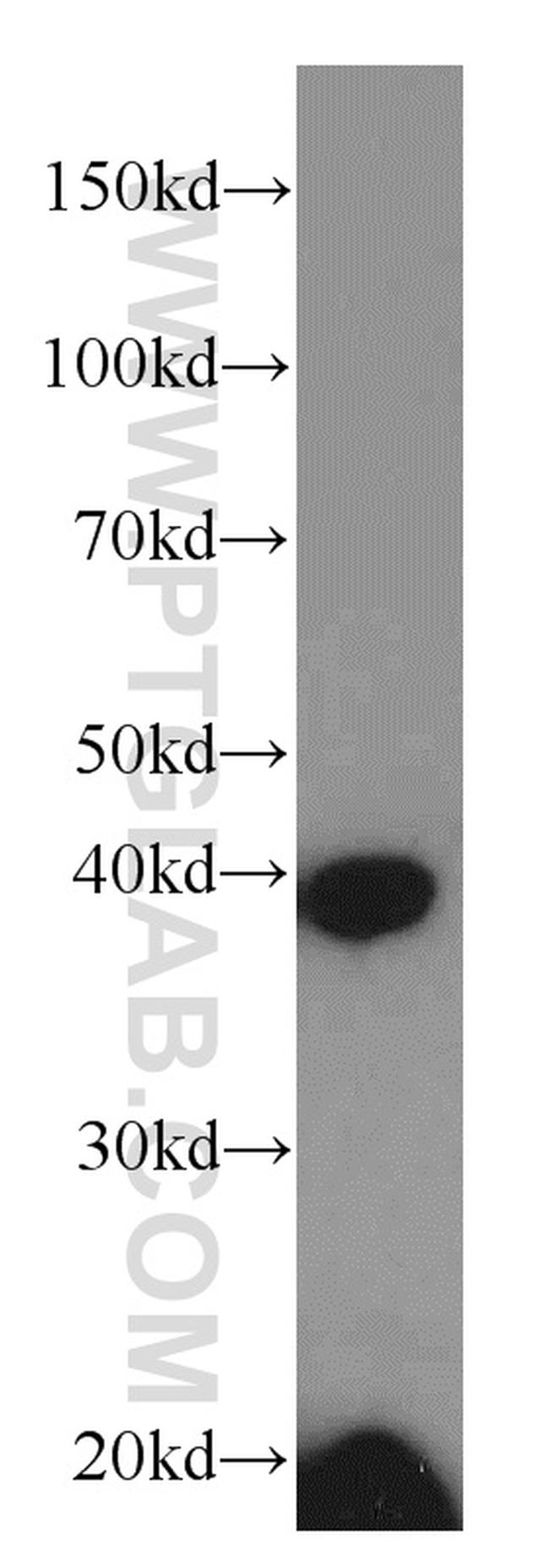 FA2H Antibody in Western Blot (WB)