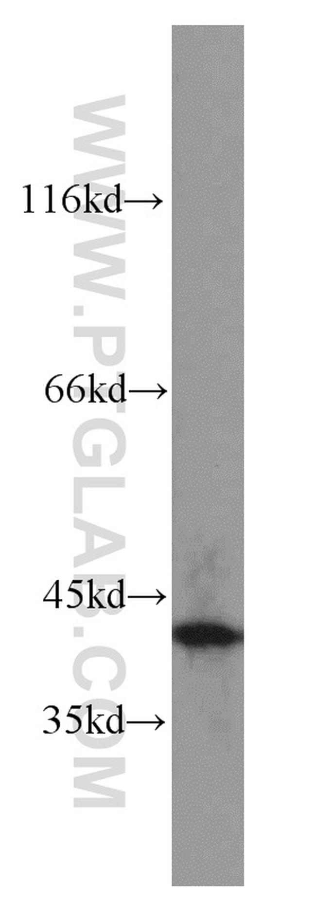 FA2H Antibody in Western Blot (WB)