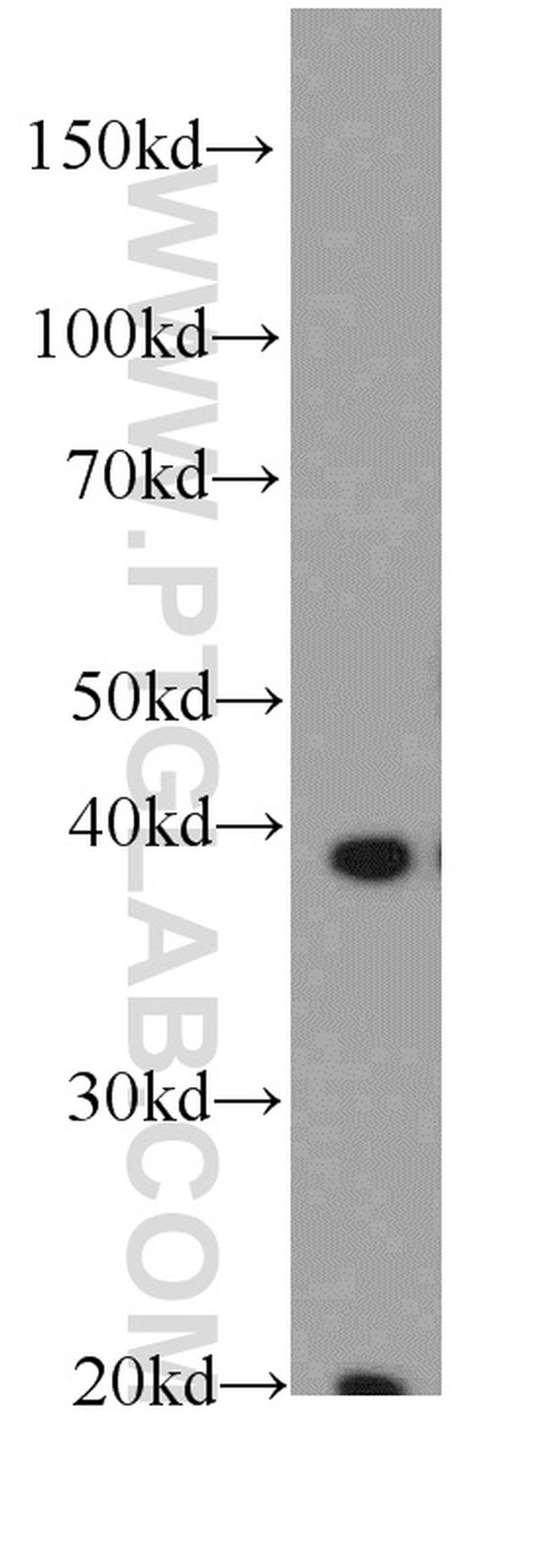 FA2H Antibody in Western Blot (WB)