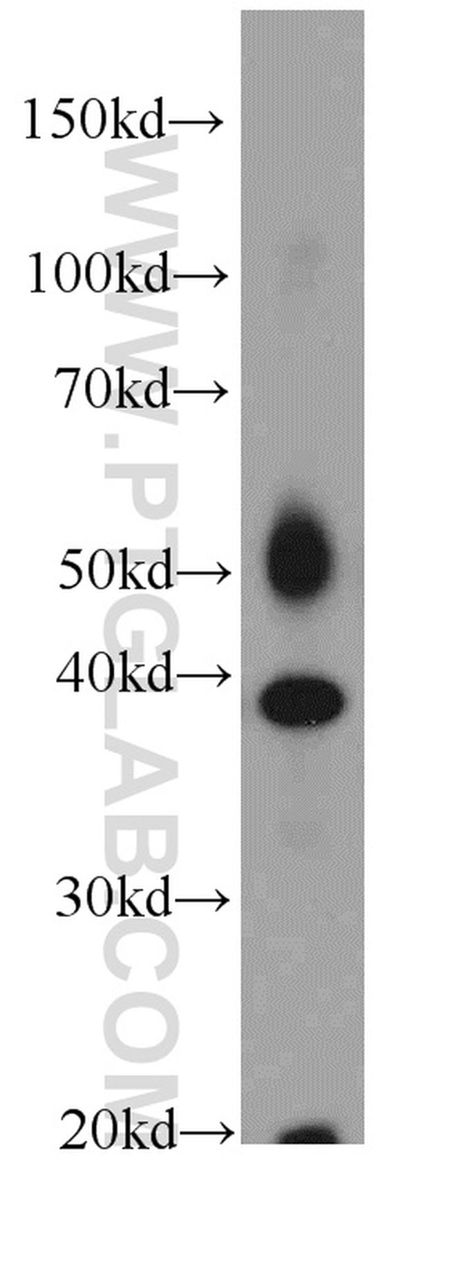 FA2H Antibody in Western Blot (WB)