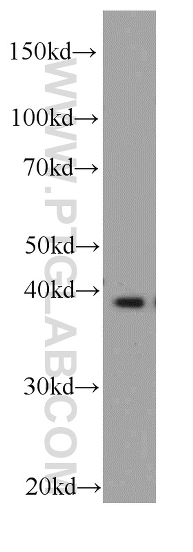 FA2H Antibody in Western Blot (WB)