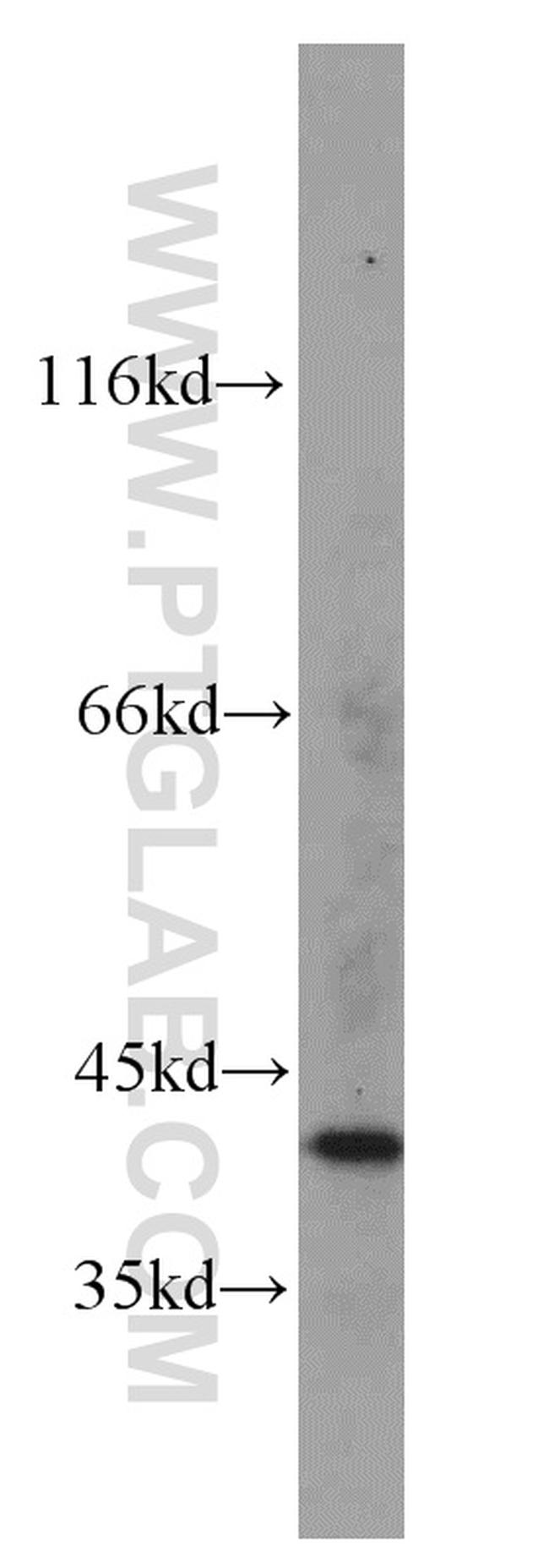 FA2H Antibody in Western Blot (WB)