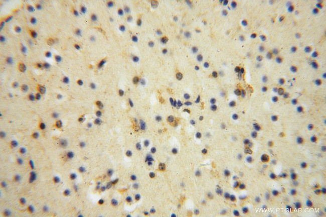 MYLIP Antibody in Immunohistochemistry (Paraffin) (IHC (P))