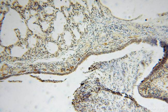 MYLIP Antibody in Immunohistochemistry (Paraffin) (IHC (P))