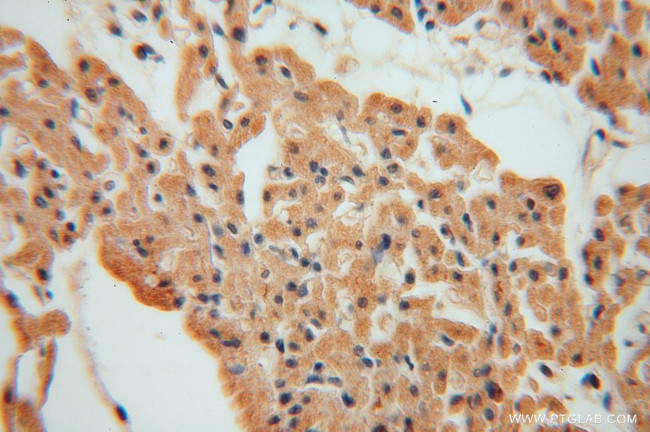 MYLIP Antibody in Immunohistochemistry (Paraffin) (IHC (P))