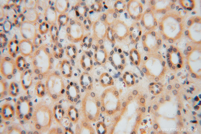 MYLIP Antibody in Immunohistochemistry (Paraffin) (IHC (P))