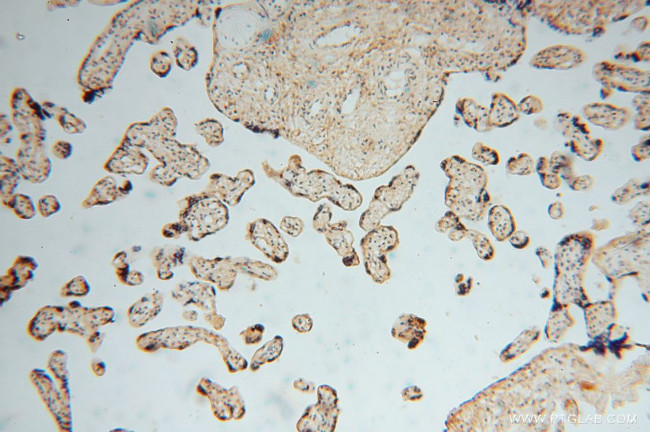 MYLIP Antibody in Immunohistochemistry (Paraffin) (IHC (P))