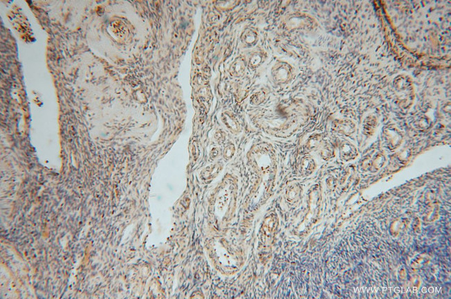 MYLIP Antibody in Immunohistochemistry (Paraffin) (IHC (P))