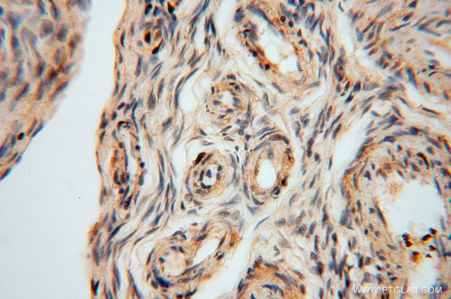 MYLIP Antibody in Immunohistochemistry (Paraffin) (IHC (P))