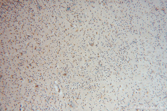 MYLIP Antibody in Immunohistochemistry (Paraffin) (IHC (P))