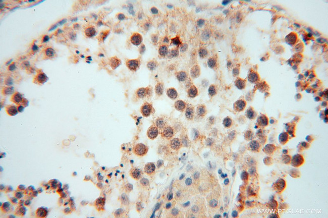 MYLIP Antibody in Immunohistochemistry (Paraffin) (IHC (P))