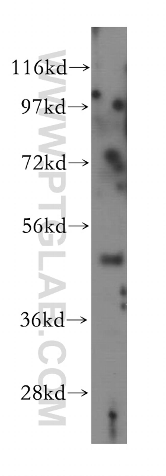 MYLIP Antibody in Western Blot (WB)