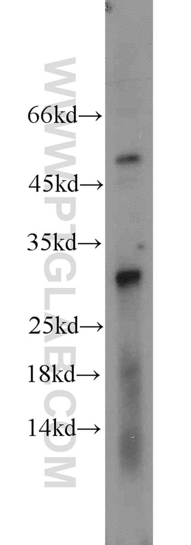 NOL12 Antibody in Western Blot (WB)