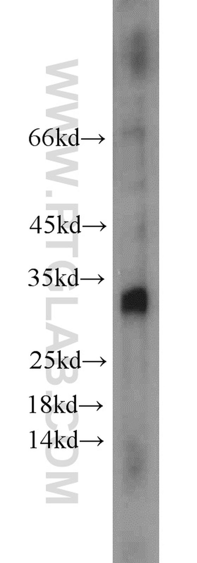 NOL12 Antibody in Western Blot (WB)