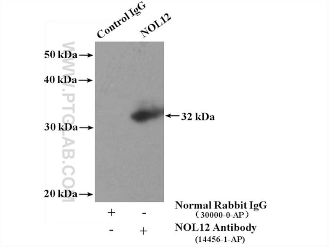 NOL12 Antibody in Immunoprecipitation (IP)