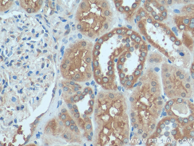 HOOK3 Antibody in Immunohistochemistry (Paraffin) (IHC (P))