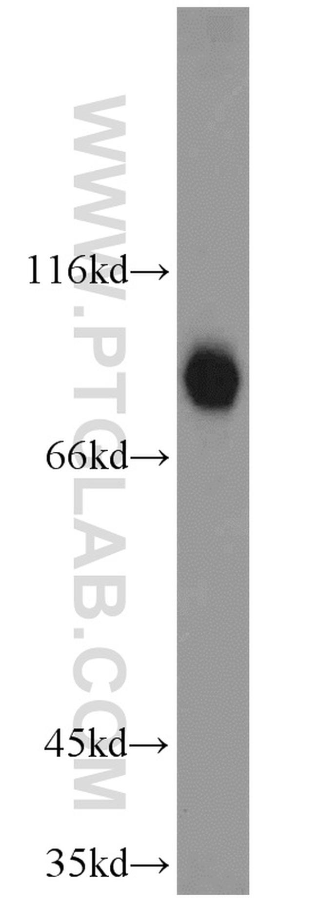 HOOK3 Antibody in Western Blot (WB)