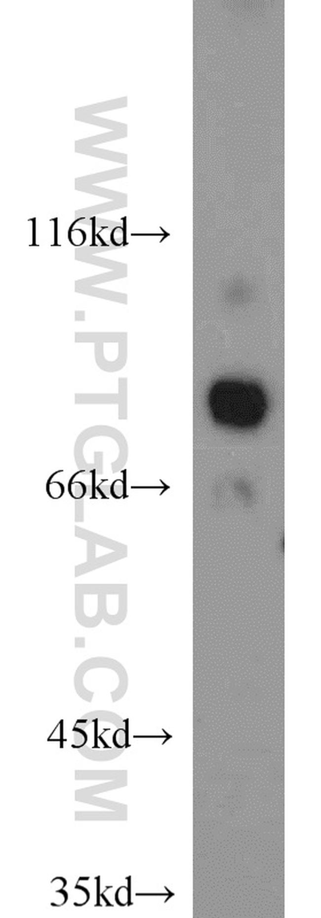 HOOK3 Antibody in Western Blot (WB)