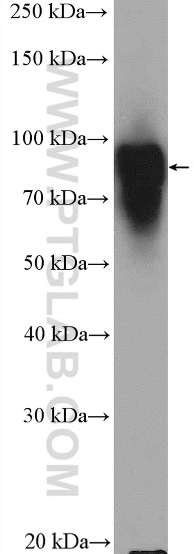 HOOK3 Antibody in Western Blot (WB)