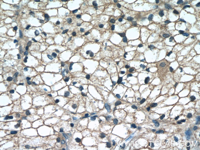 WIT1 Antibody in Immunohistochemistry (Paraffin) (IHC (P))