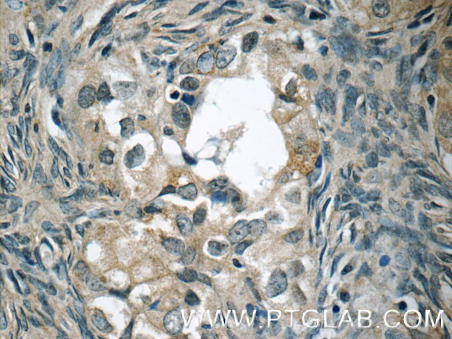 WIT1 Antibody in Immunohistochemistry (Paraffin) (IHC (P))