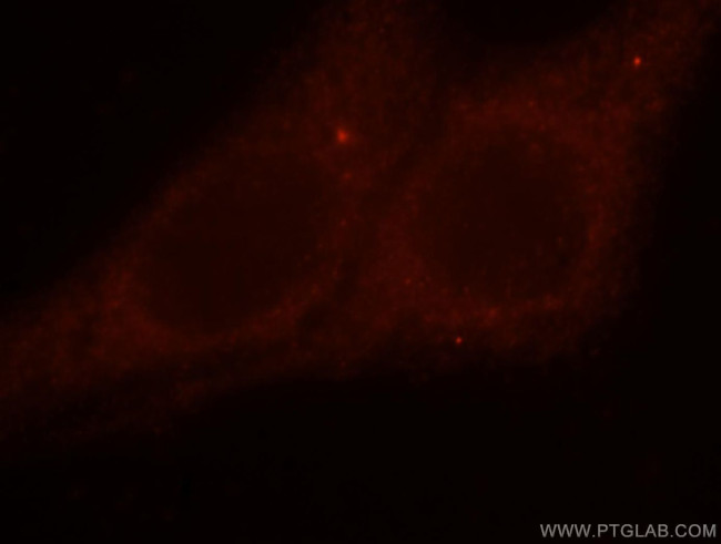 DLC1 Antibody in Immunocytochemistry (ICC/IF)